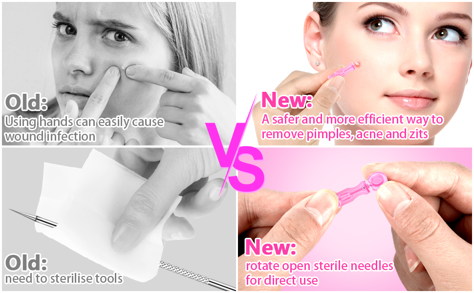 Sterile Needles for Pimples
