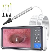 ScopeAround Otoscope Ear Camera with 4.5" IPS Screen, 1920x1080 FHD Smart Visual Ear Cleaner with...