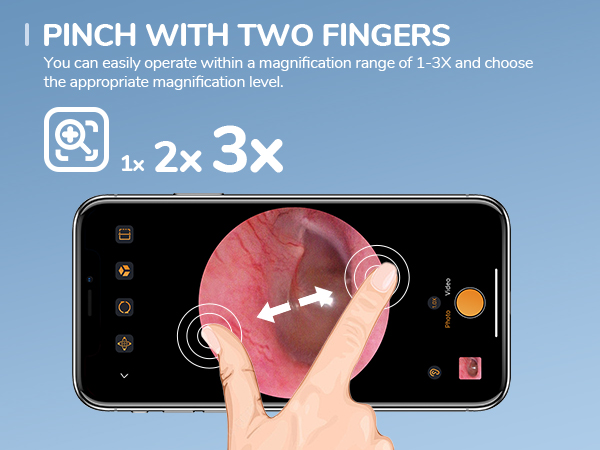 otoscope with light ear scope