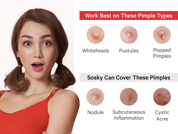 Zit stickers work best on all types whiteheads patches pustules patches poped pimples patches