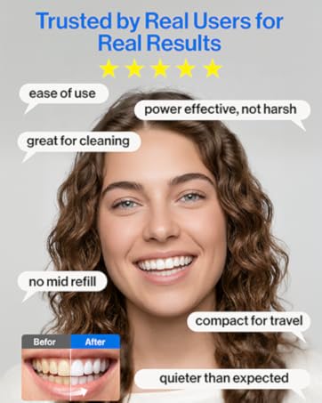 water flosser