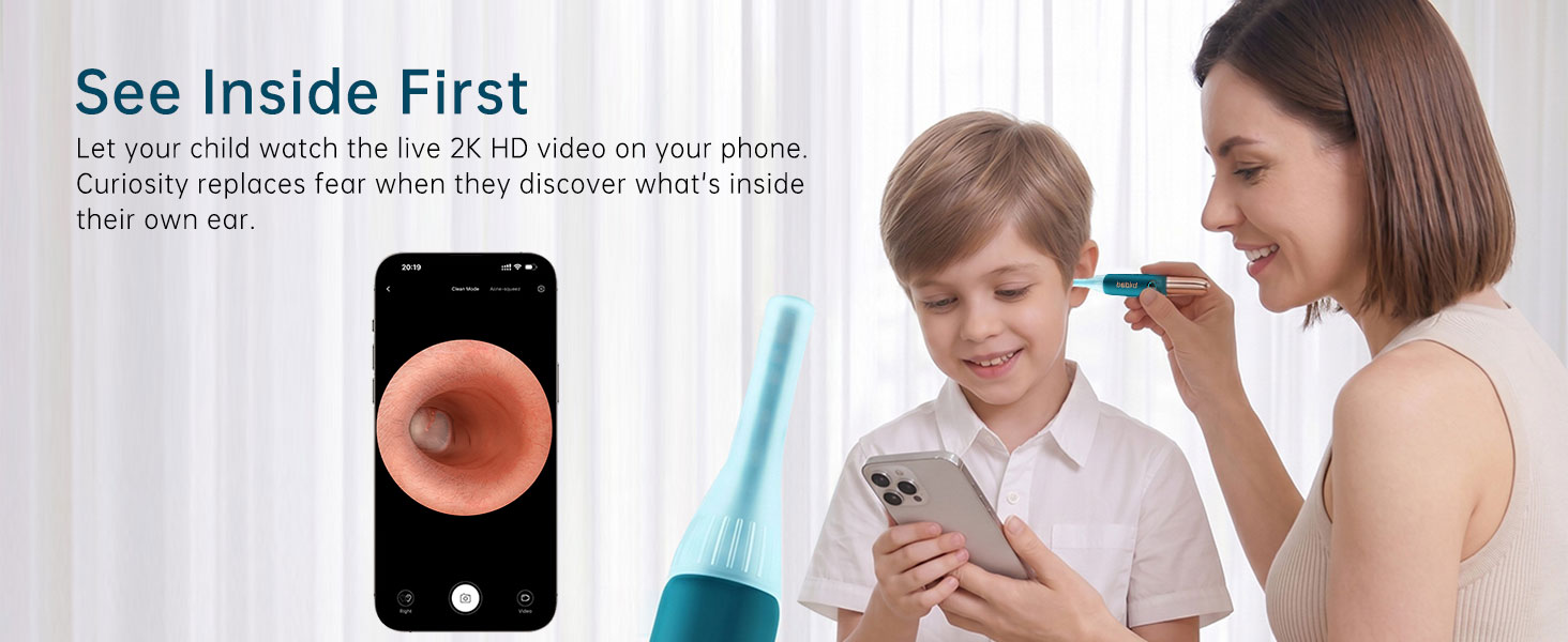 ear cleaning camera