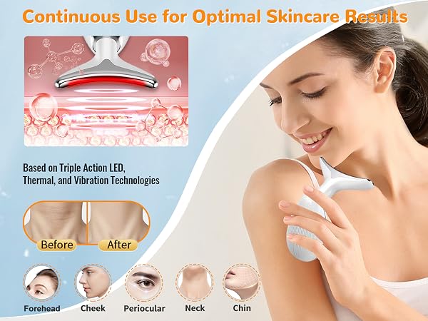 Facial Beauty Device