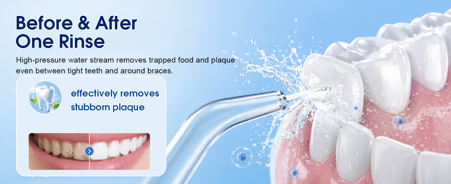 Water Flosser 