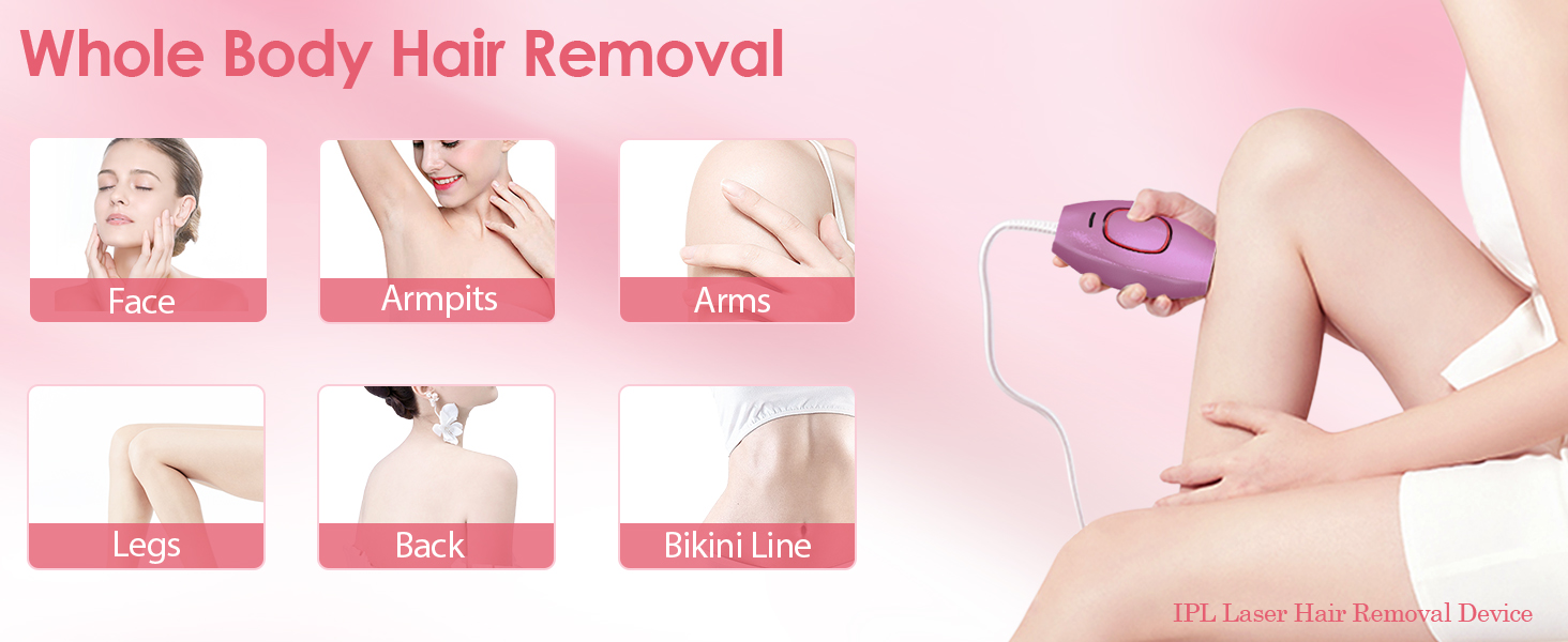 hair removal laser