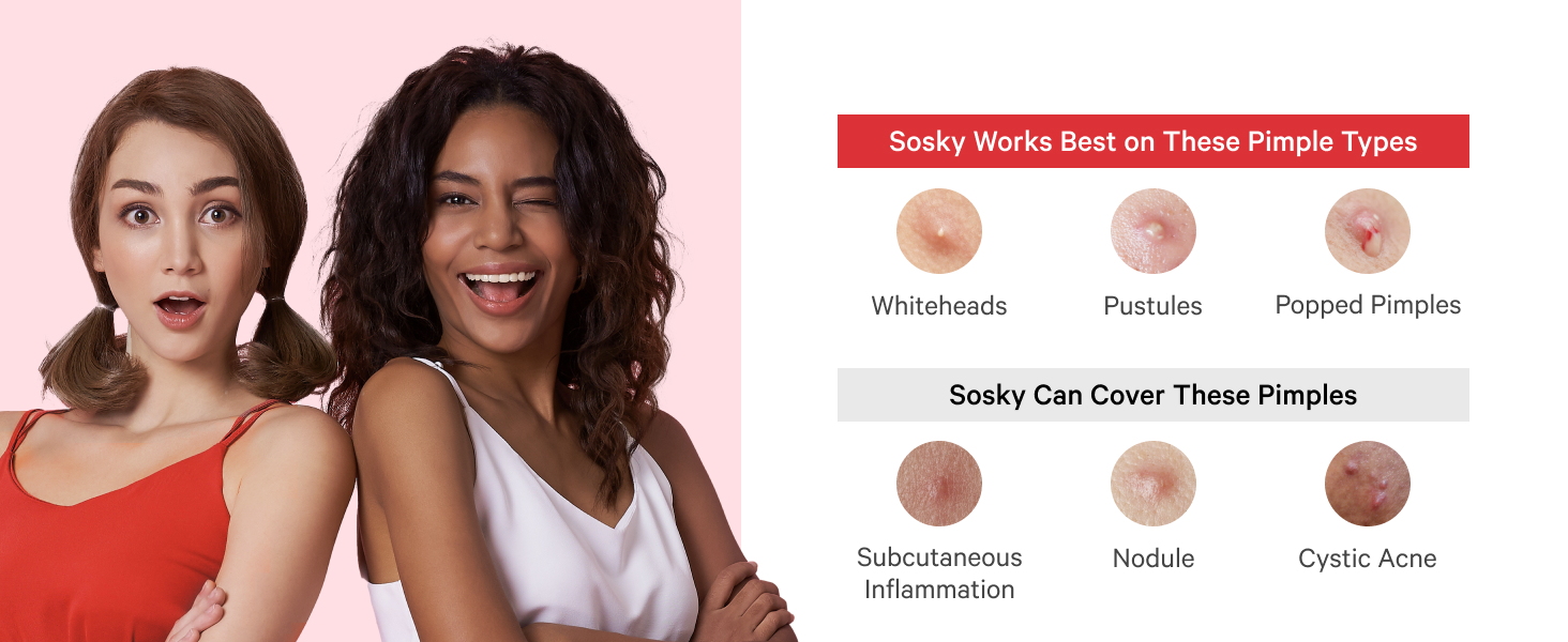Zit stickers work best on all types whiteheads patches pustules patches poped pimples patches