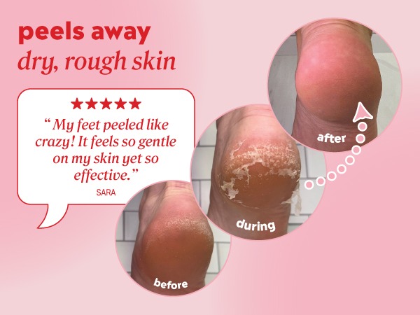 Customer review: My feet peeled like crazy! It feels so gentle on my skin yet so effective"