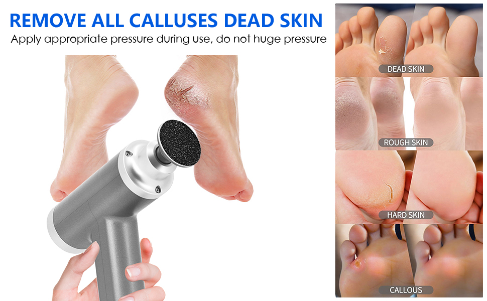 electric callus remover