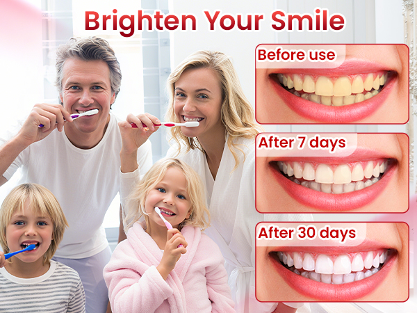 SP-6 Probiotic Brightening Toothpaste sp6 probiotic toothpaste whitening sp-6 probiotics whitening