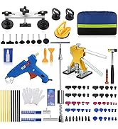 ROADGIVE 100PCS Paintless Dent Repair Kit, Adjustable Dent Removal Kit Auto Body Dent Repair Tool...