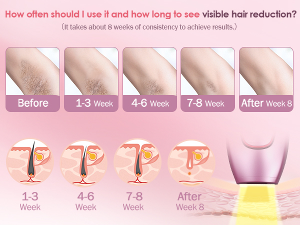 laser depiladora para mujer