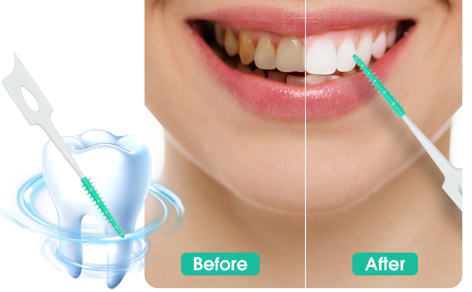 dental picks