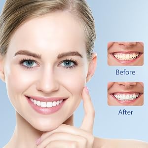 Teeth whitening led light