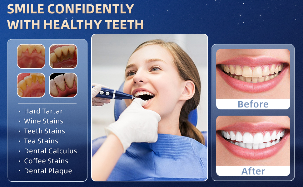 teeth stains remover