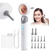 Otoscope Ear Camera with 1.38” Screen, 1080P HD Ear Scope &amp; 4 LED Lights for Adult Kid and Pet, 1...