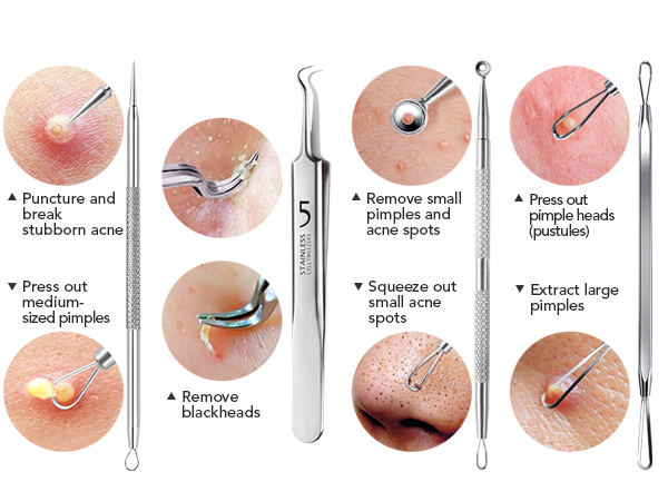 pore prep tool