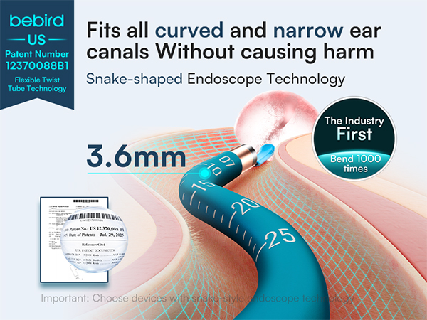 ear camera wax removal