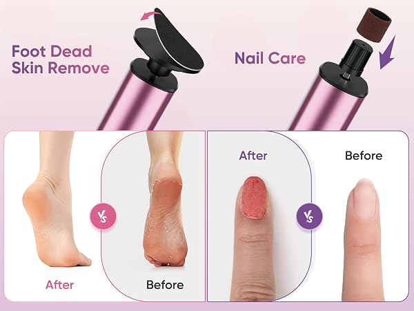 electric feet callus remover