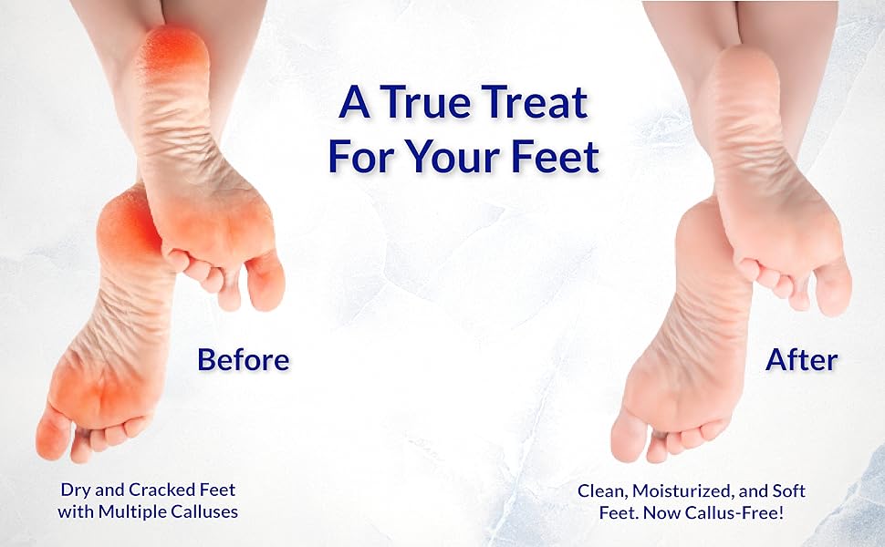 foot soaking tub foot bath foot soak tub feet soaking tub foot basin foot bath soak tub for soaking