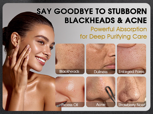 Blackhead Remover Mask Kit