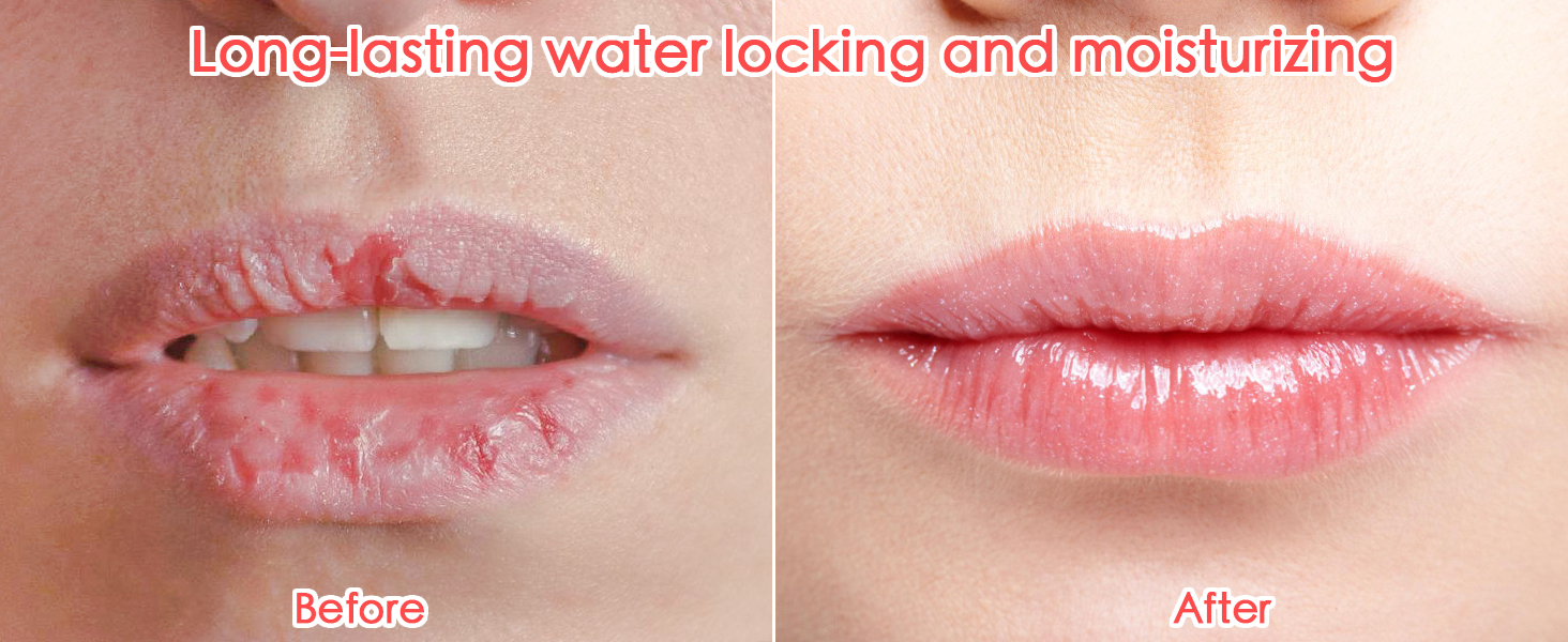 lip balm multipack