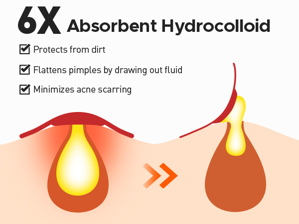 6 X Absorbent Hydrocolloid
