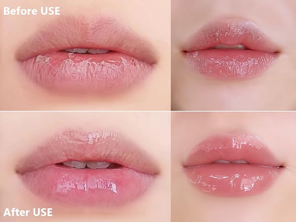 lip repair