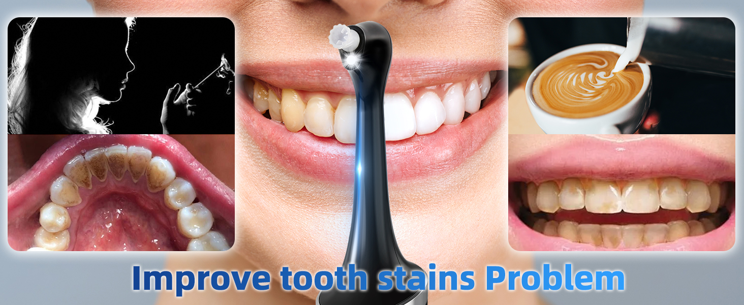 Teeth Whitening Kits
