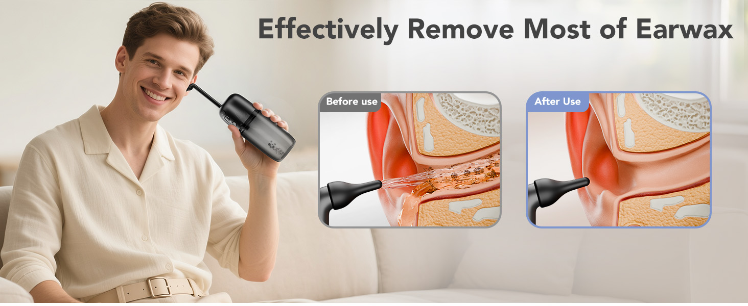 ear wax removal kit