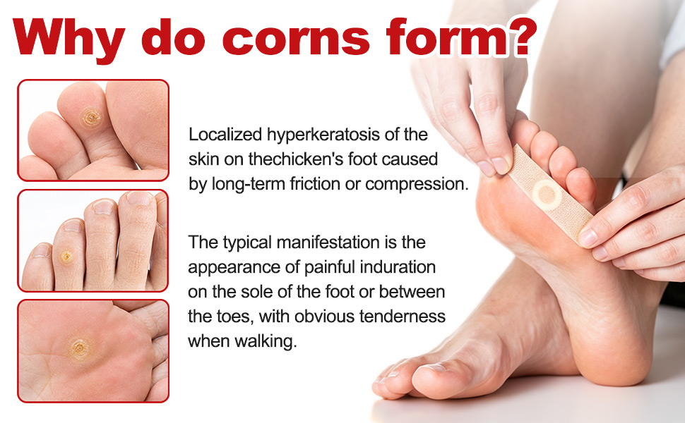 foot corn remover
