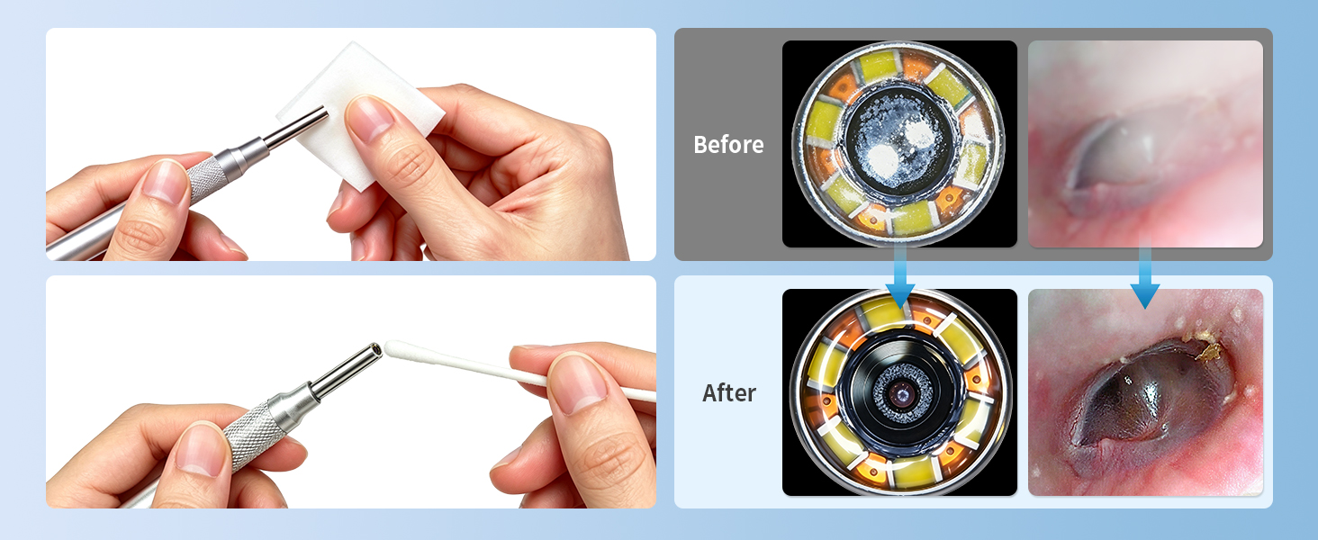 ear wax removal, ear cleaner with camera, ear wax removal kit, ear wax removal tool camera