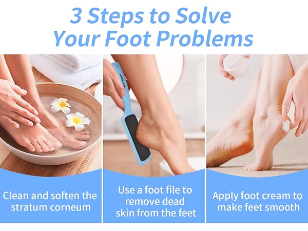 Foot File for Dead Skin