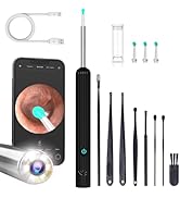 Ear Wax Removal, Ear Wax Removal Kit with 1080P HD Camera,Ear Cleaning Kit with 4 Ear Spoon, Otos...