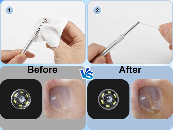 Ear camera lens cleaning before and after comparison for clear HD view