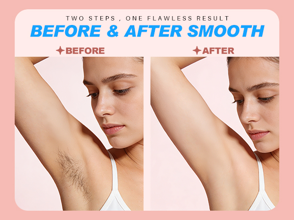 bikini trimmer