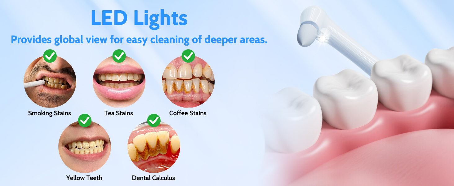 Plaque Remover for Teeth