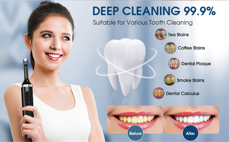 Tooth Polisher