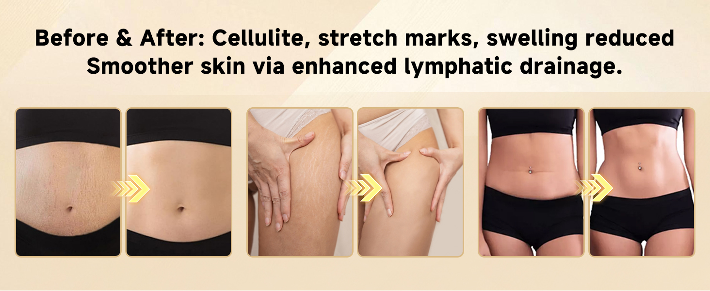 cellulite massage tool