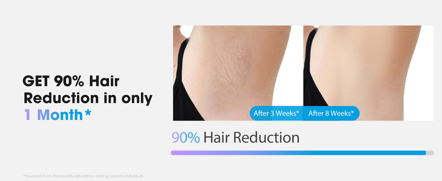 laser hair removal for women