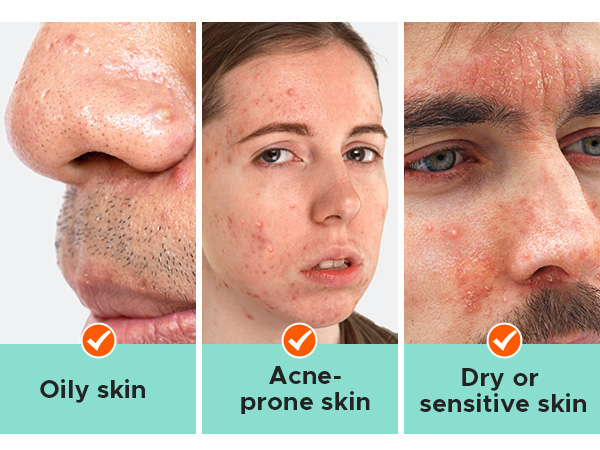 For All Skin Types