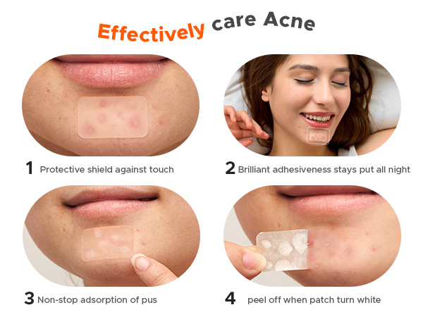 large pimple patches