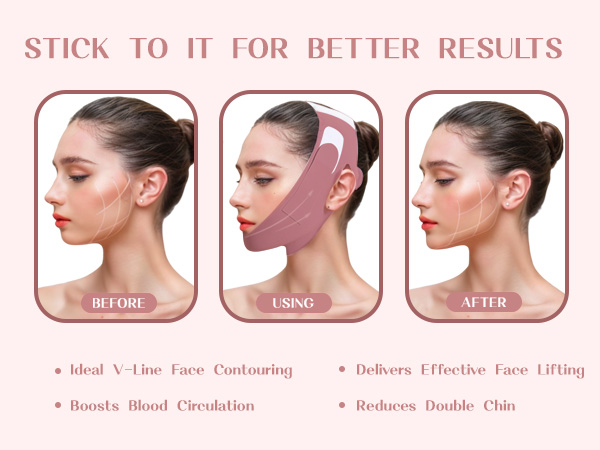  Anti Snoring Chin Strap 