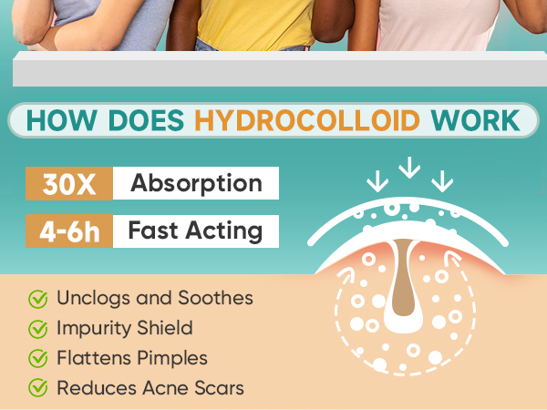 HOW DOES HYDROCOLLOID WORK