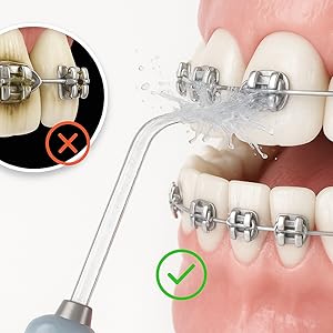 Water Flosserwater flosser