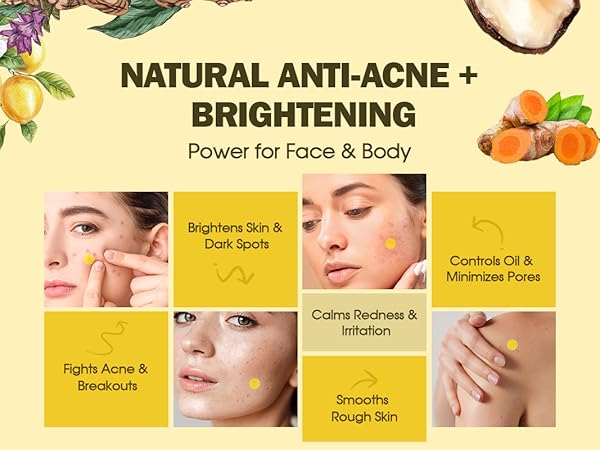 Natural Anti-Acne