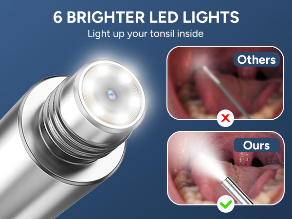 Tonsil Stone Remover with Camera