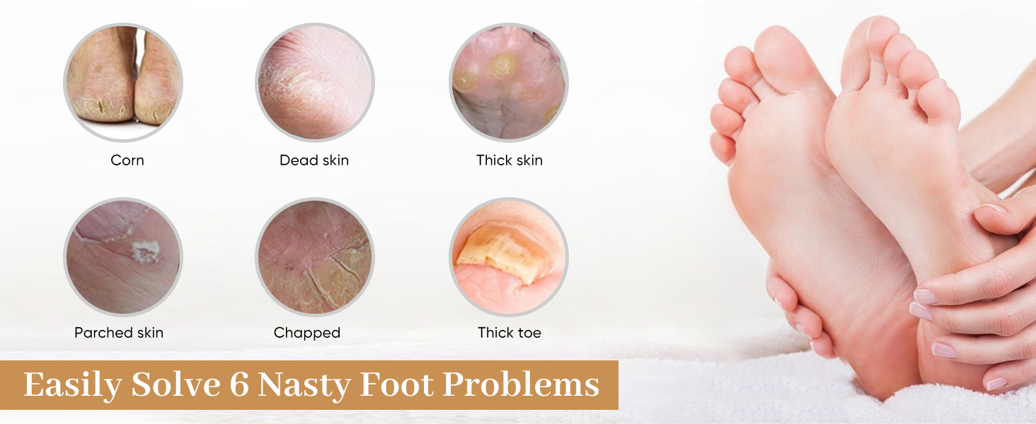 Foot File