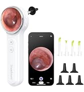 ScopeAround Digital Otoscope Camera w/Built-in Screen, Otoscope with Light Ear Scope for Home Use...