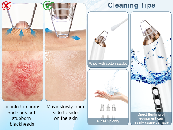 blackhead vacuum
