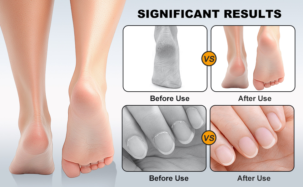 Significant Results